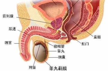 睾丸囊肿