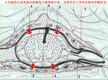 结核性脊髓炎