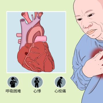 冠状动脉瘘-冠状动脉瘘