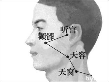 听宫-听宫
