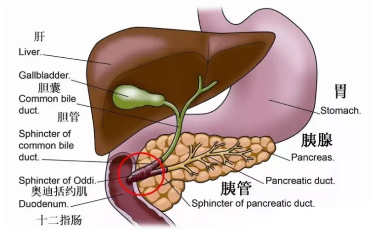 胰腺炎