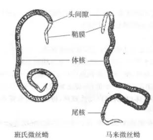 丝虫病