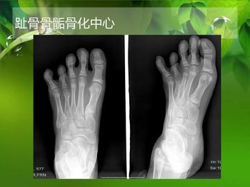 骨化中心-快懂百科