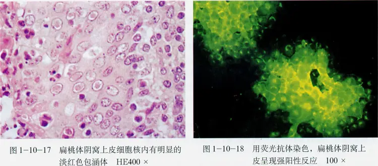 流行性乙型脑炎病毒