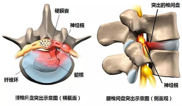 硬膜囊- 抖音百科